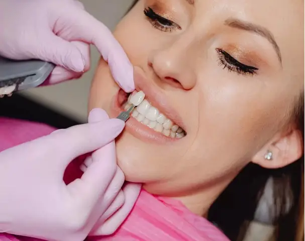 Fatete Dentare din Zirconiu la Dental CATTED